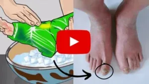 Macular Degeneration Research